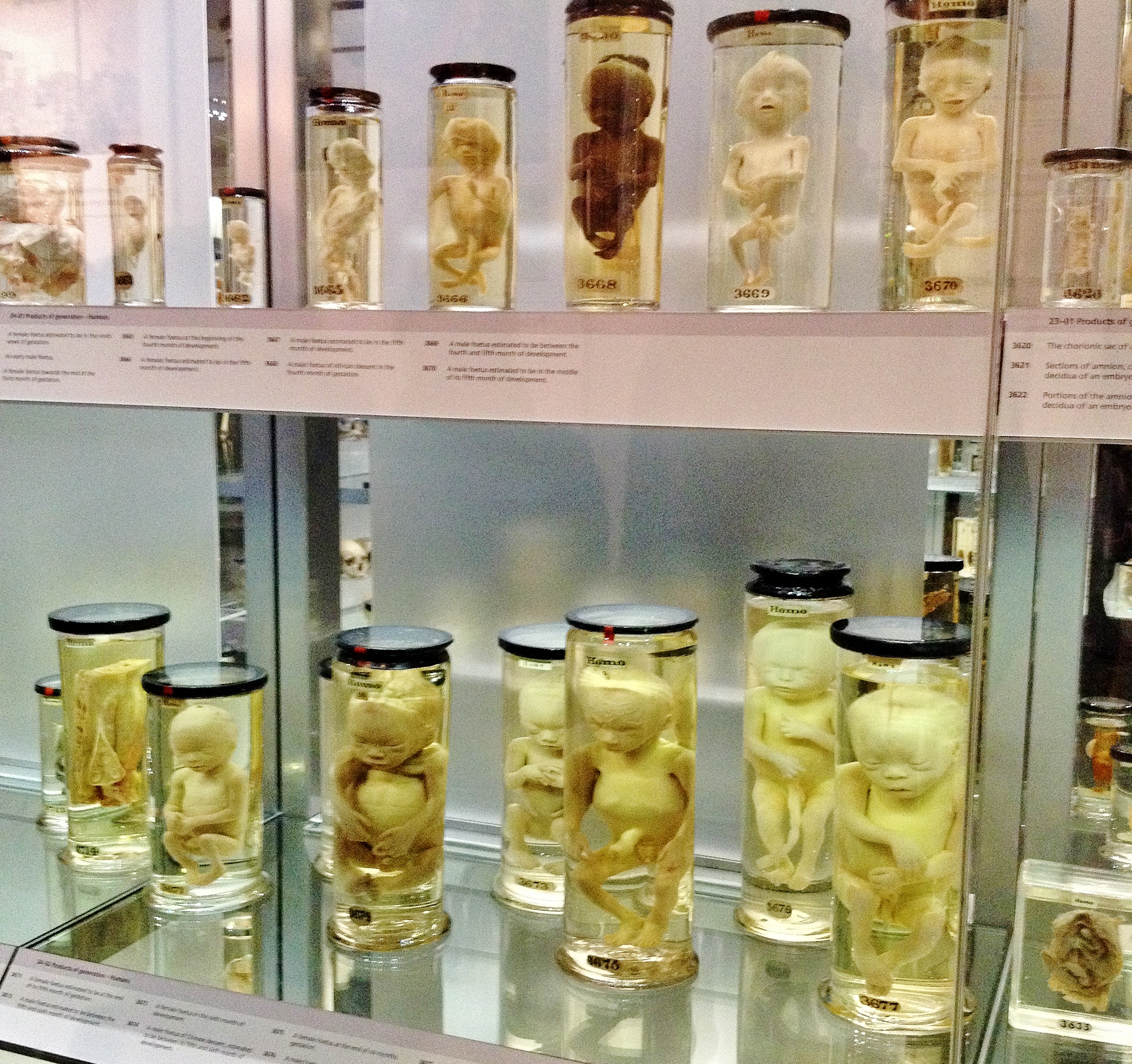 Foetuses inside the Hunterian Museum