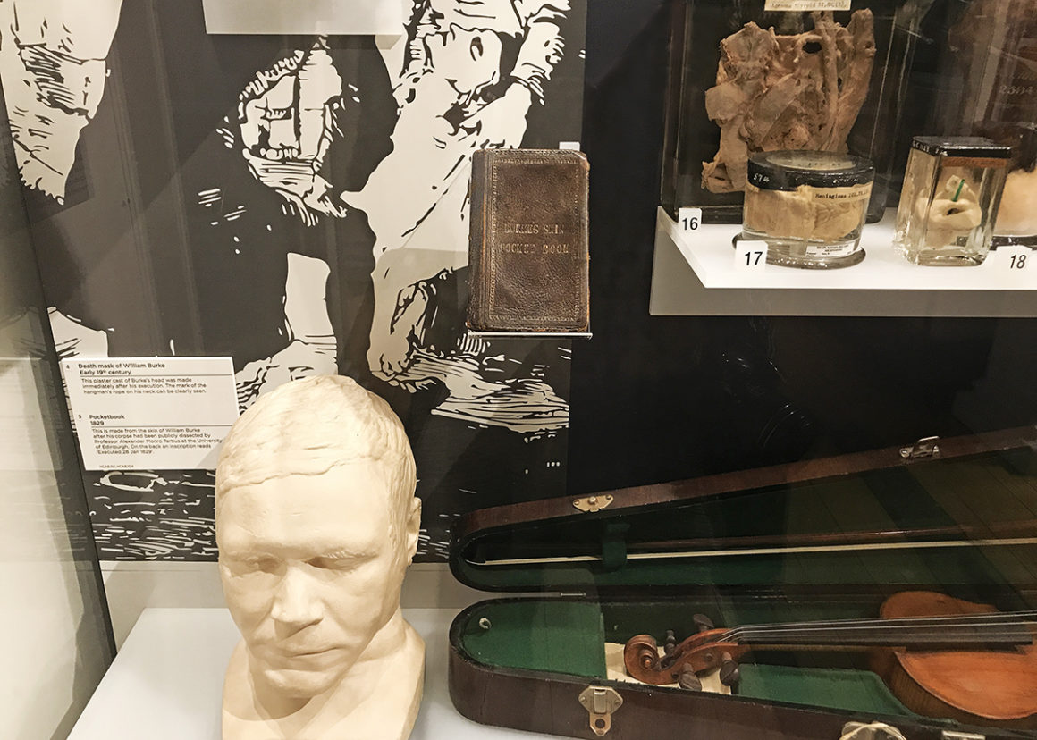 William Burke's death mask inside Surgeons' Hall Museum in Edinburgh