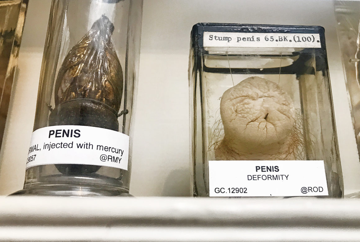 Curiosities inside Surgeons' Hall Museum, Edinburgh