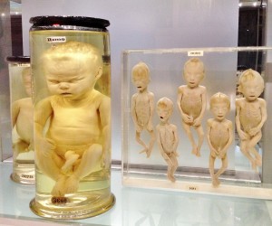 Foetuses inside the Hunterian Museum in London