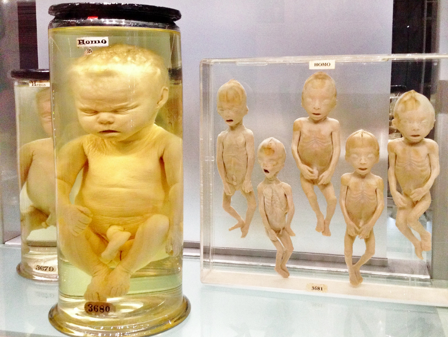 Hunterian Museum - visit London's most unusual and quirky museums
